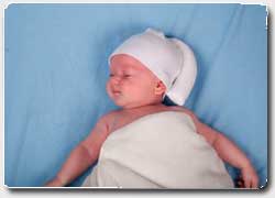 Бизнес идея №3369. Шапочка-бини для младенцев против синдрома плоской головы (плагиоцефалии)