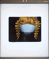 Французская вышивка на рентгеновских снимках Мэтью Кокс 
