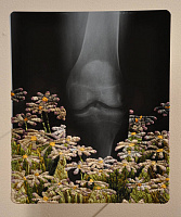 Французская вышивка на рентгеновских снимках Мэтью Кокс 